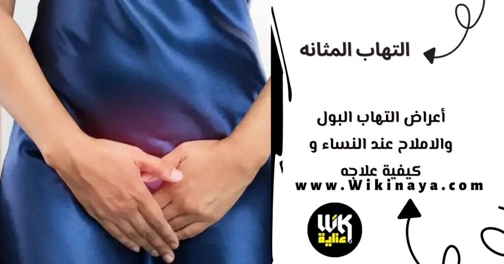 أعراض التهاب البول والاملاح عند النساء و كيفية علاجه