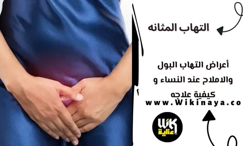 أعراض التهاب البول والاملاح عند النساء و كيفية علاجه