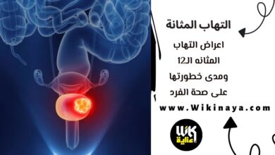 اعراض التهاب المثانه الـ12 ومدى خطورتها على صحة الفرد