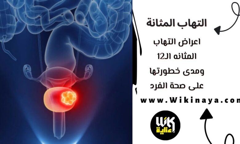 اعراض التهاب المثانه الـ12 ومدى خطورتها على صحة الفرد