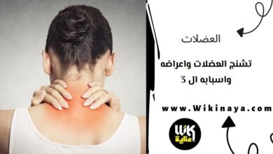 تشنج العضلات واعراضه واسبابه ال 3