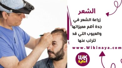 زراعة الشعر في جدة أهم مميزاتها والعيوب التي قد تترتب عنها