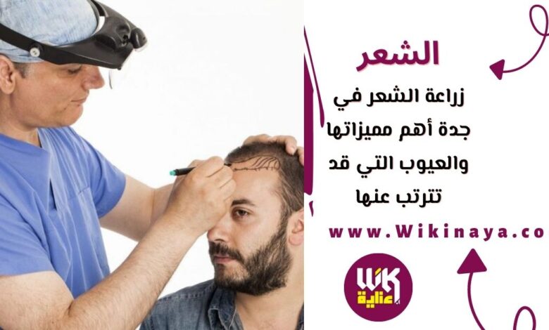 زراعة الشعر في جدة أهم مميزاتها والعيوب التي قد تترتب عنها