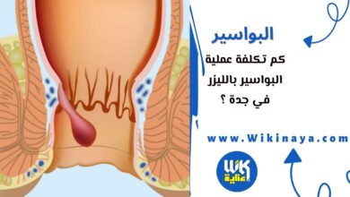 كم تكلفة عملية البواسير بالليزر في جدة ؟