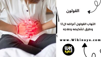 التهاب القولون أعراضه ال12 وطرق تشخيصه وعلاجه