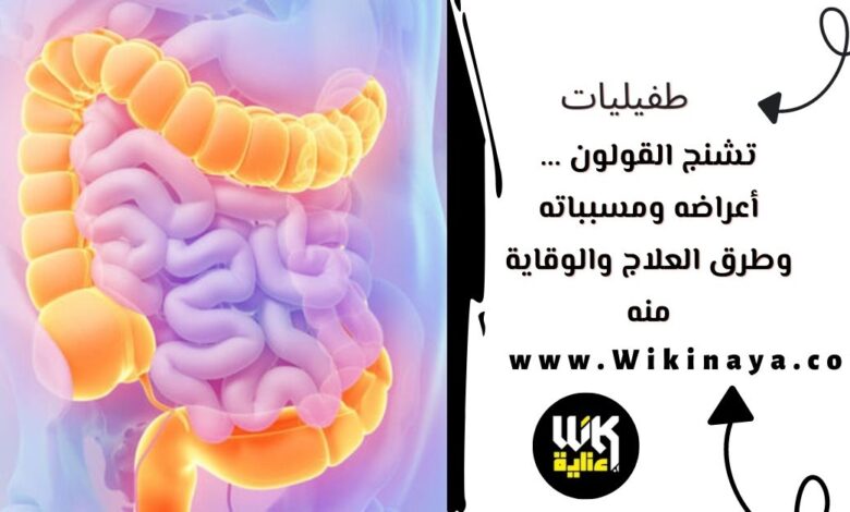 تشنج القولون ... أعراضه ومسبباته وطرق العلاج والوقاية منه