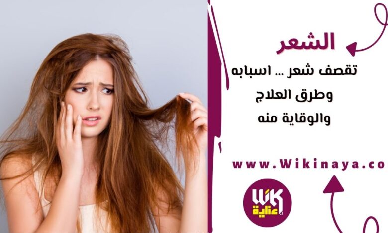 تقصف شعر … اسبابه وطرق العلاج والوقاية منه