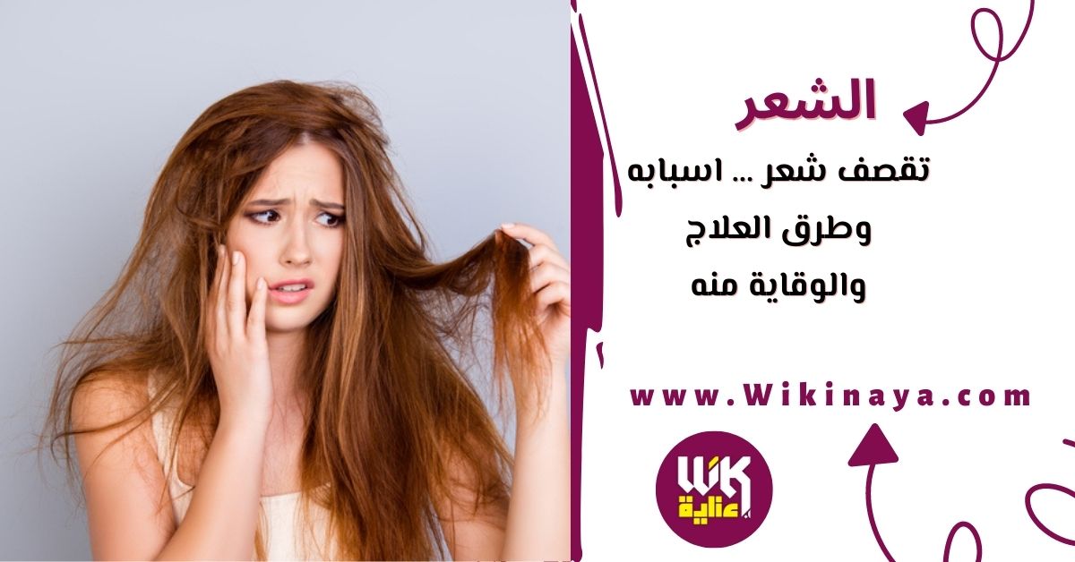 تقصف شعر … اسبابه وطرق العلاج والوقاية منه