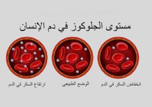 نسبة السكر في الدم