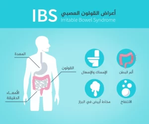 هل القولون العصبي خطير