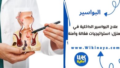 علاج البواسير الداخلية في المنزل