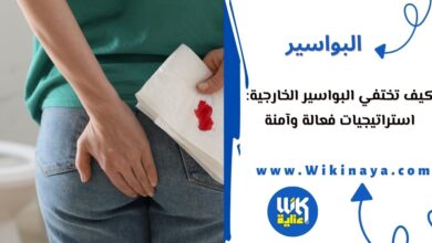 كيف تختفي البواسير الخارجية