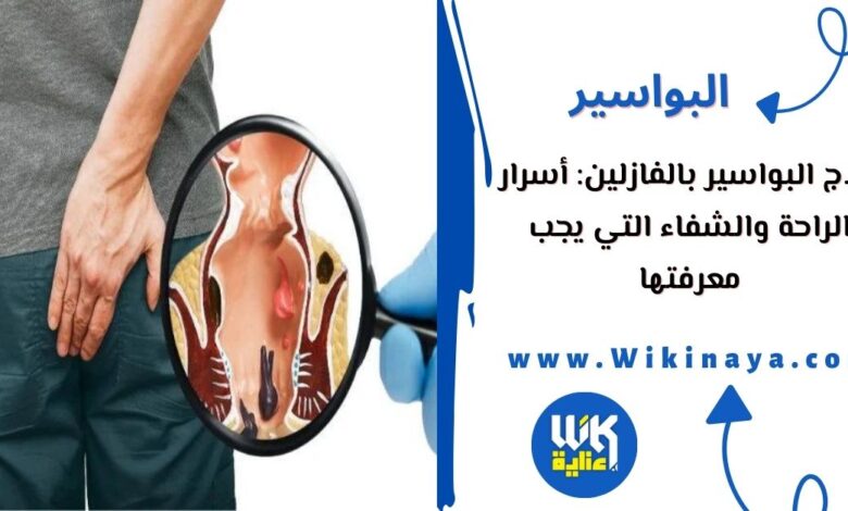 علاج البواسير بالفازلين